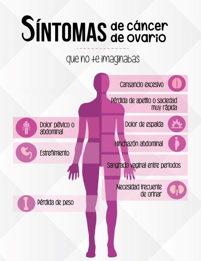 El cáncer de ovario una enfermedad silenciosa: Pro Oncavi
