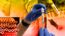 La OMS registra más de 34,000 casos y 138 muertes por mpox en el mundo en lo que va de 2025