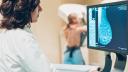 Detectar el cáncer de mama a tiempo: cuánto cuestan hacerse una mastografía o ultrasonido, según Profeco