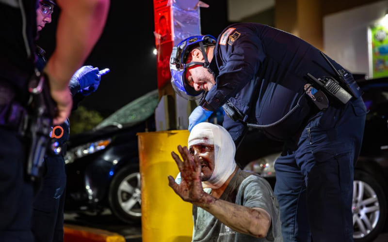 Atropellan a indigente en la calle Segunda