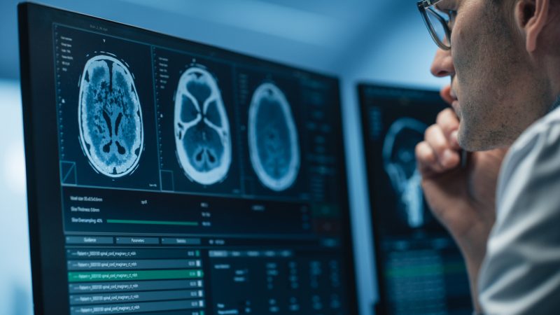 Los adolescentes de 30 años son una realidad, la Universidad de Cambridge revela las edades del cerebro